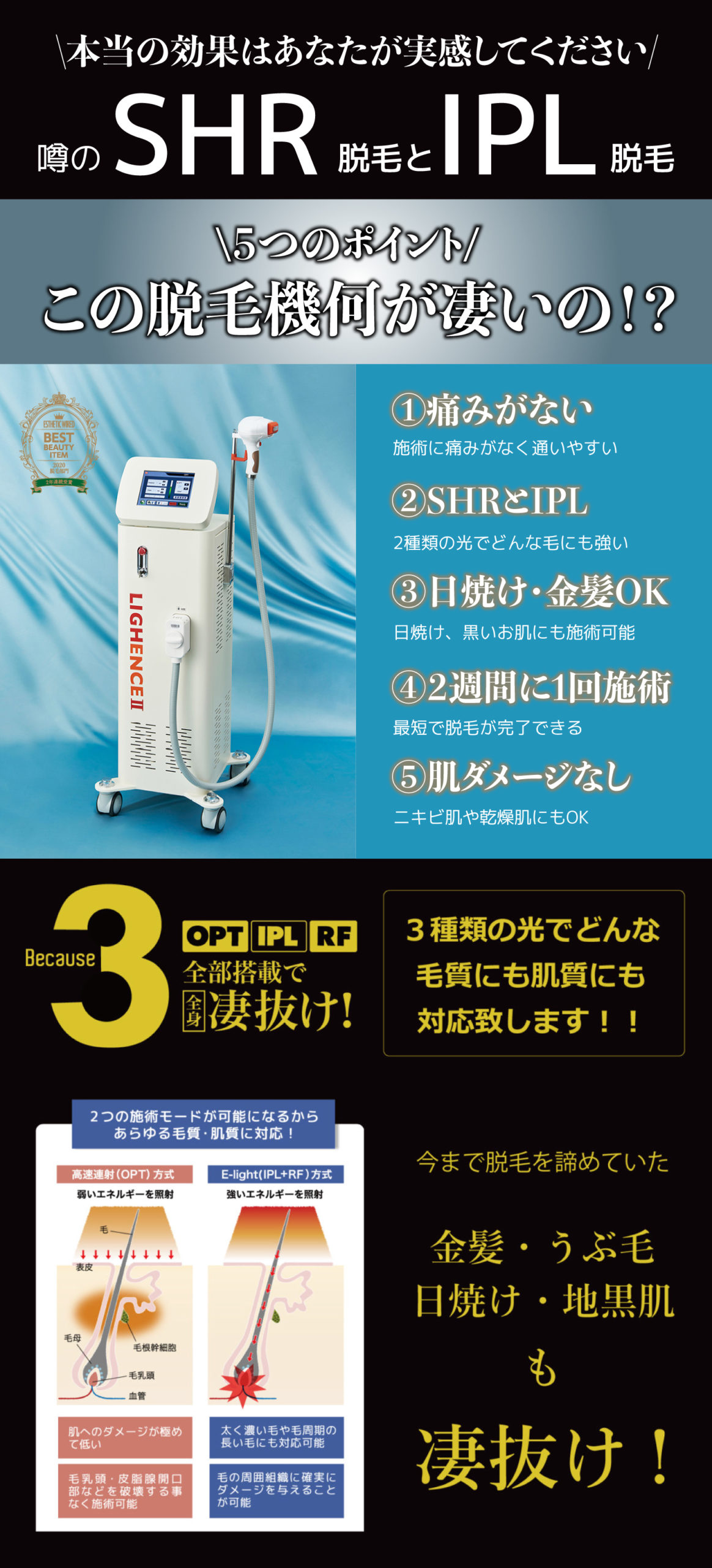 初めてのメンズ光脱毛 Shr脱毛とipl脱毛がわかる５つのポイント 沖縄メンズ脱毛ならso What北谷店 初めてのヒゲ脱毛 痛くないshr脱毛にお任せ